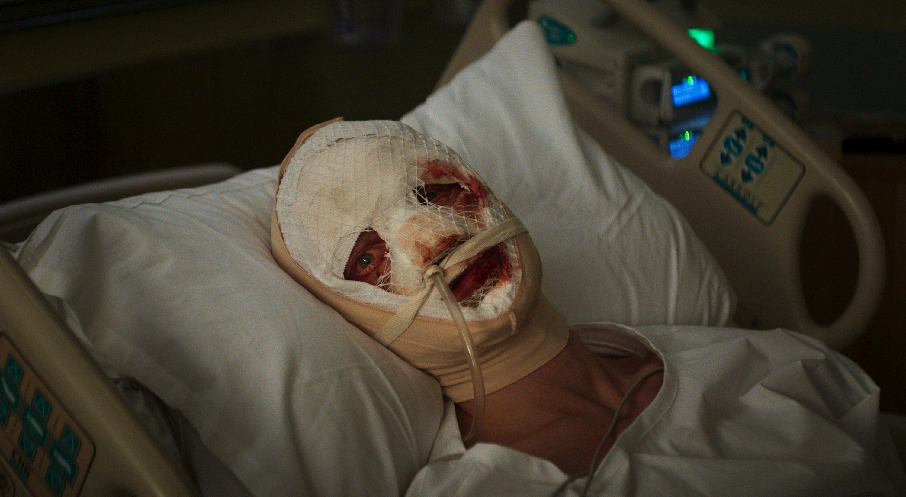 Clayface - Tom Rhys Harries as Clayface with Bandage