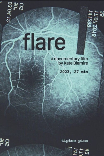 Flare