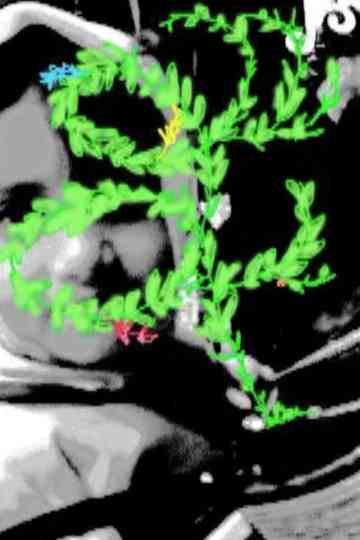 sorina street Poster