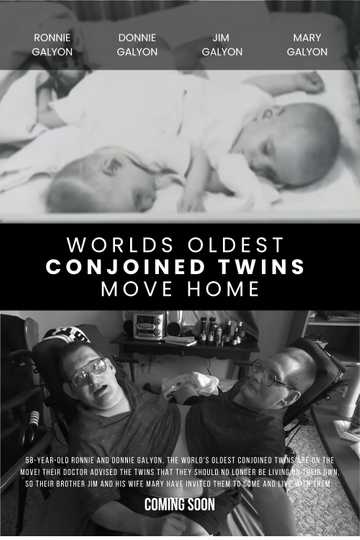 World's Oldest Conjoined Twins Move Home