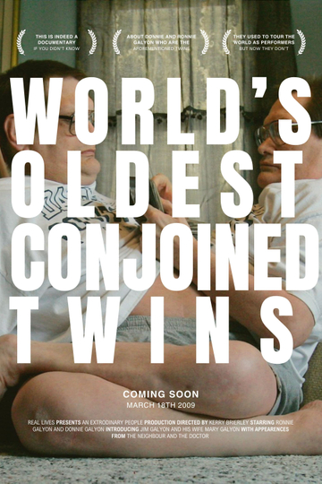 The World's Oldest Conjoined Twins Poster