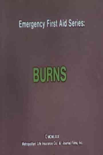Emergency First Aid Series: Burns