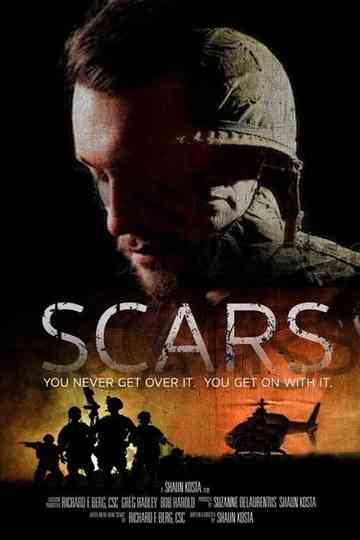 Scars