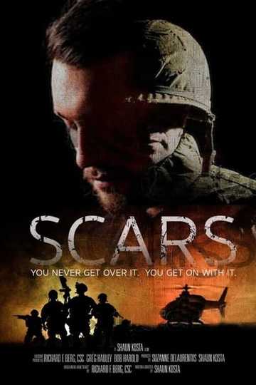 Scars