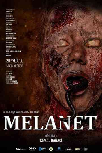 Melanet