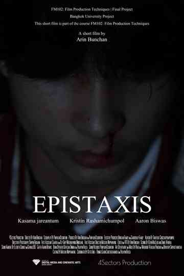 EPISTAXIS