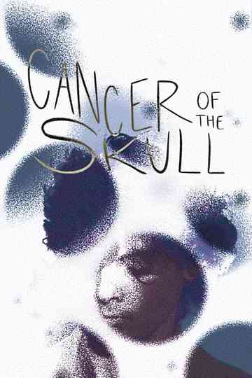 Cancer of the Skull poster
