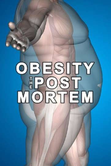 Obesity The Post Mortem Poster