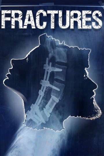 Fractures Poster