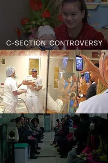 The CSection Controversy