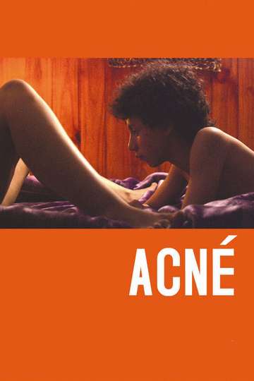 Acne Poster