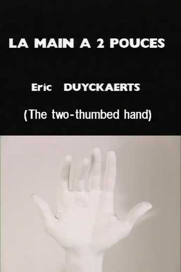 The twothumbed hand