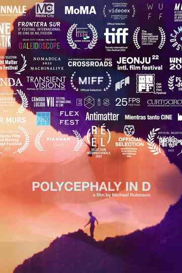 Polycephaly in D poster
