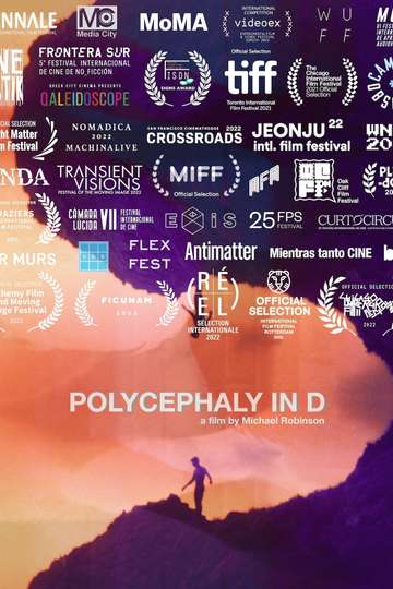Polycephaly in D Poster