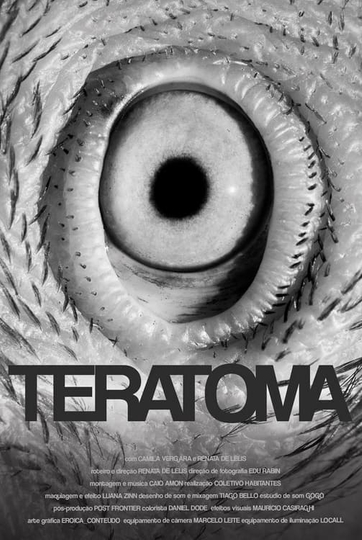 Teratoma