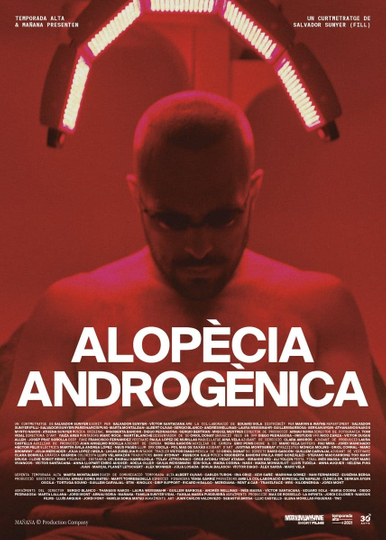 Androgenic Alopecia Poster